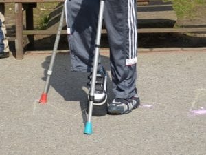 Legs of kid holding crutches
